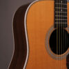 Martin HD-28 175th Anniversary (Pre-Owned) - Image 2